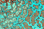 20 turquoise textures 64 Megapixel, a Texture Graphic by tkdesign (Thumbnail 7 of 20)