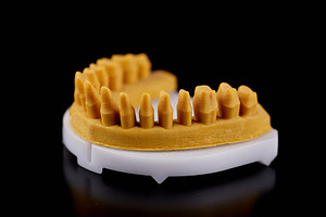3D printed dental jaw model with prepared stumps for crowns and bridges on a bl, a Health & Medical Photo by Rohan Photography
