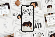 Skin Care Beauty Instagram Templates, a Social Media Template by Aesthetic Design Studio (Thumbnail 1 of 9)