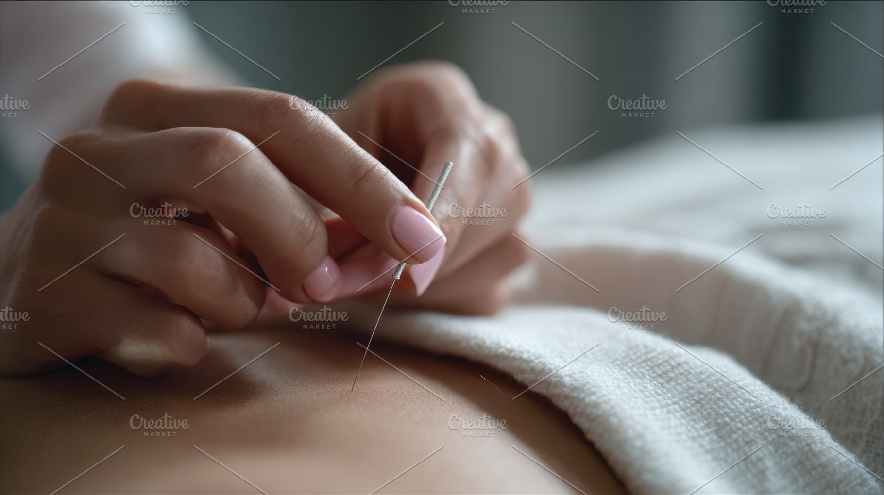 Acupuncture therapy session, a Photo by Beautiful things