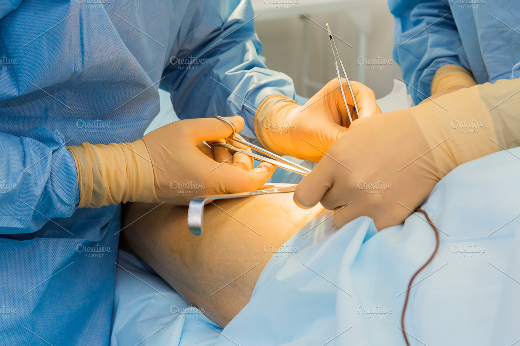 Surgery Containing Tool Team And Care