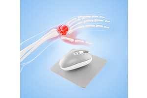 Carpal tunnel syndrome concept. 3D, a Healthcare Illustration by Marozhkastudio
