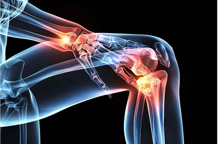 Human skeleton showing knee and, a Health & Medical Photo by Ylivdesign