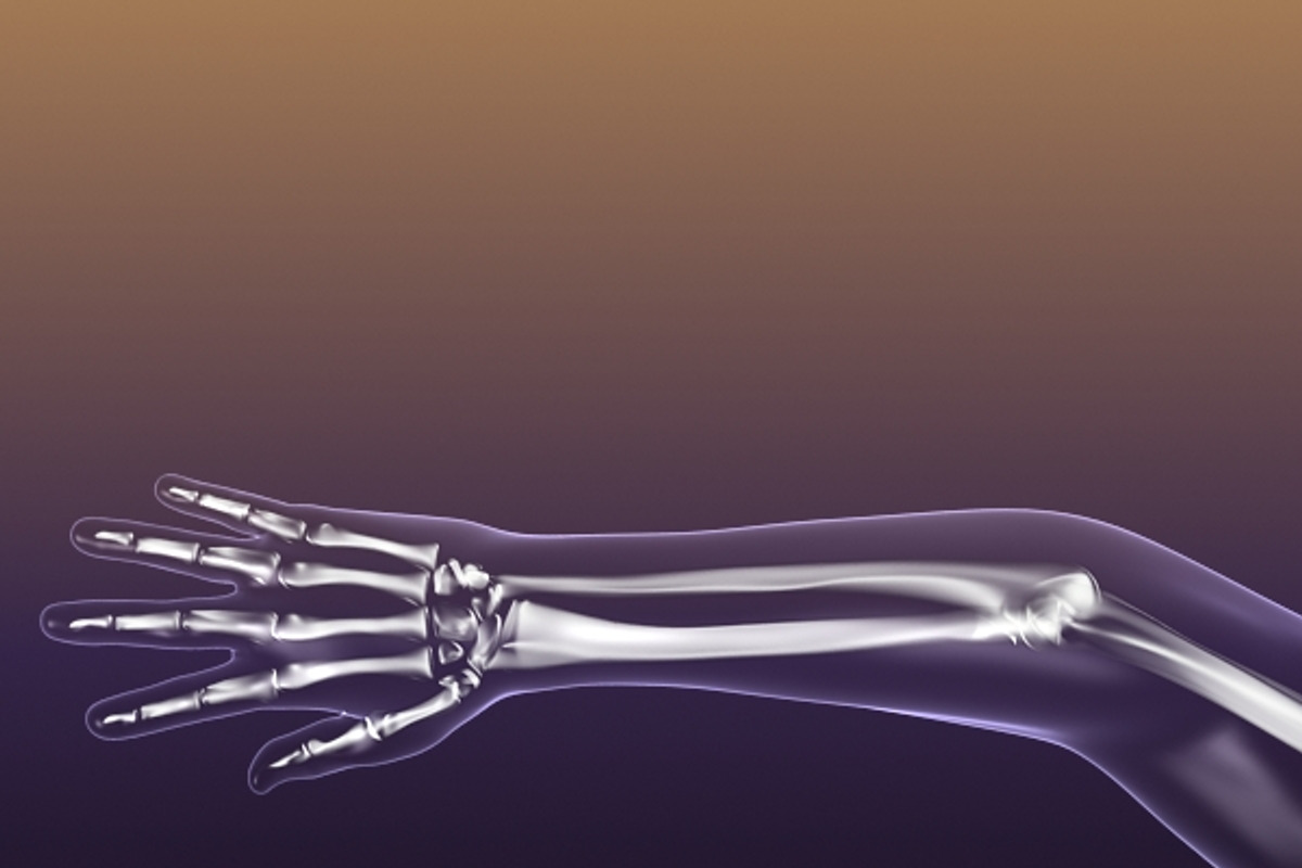 Human Skeleton in Body (X-Ray), a Characters & Person 3D Model by VisualCG (Photo 5 of 8)