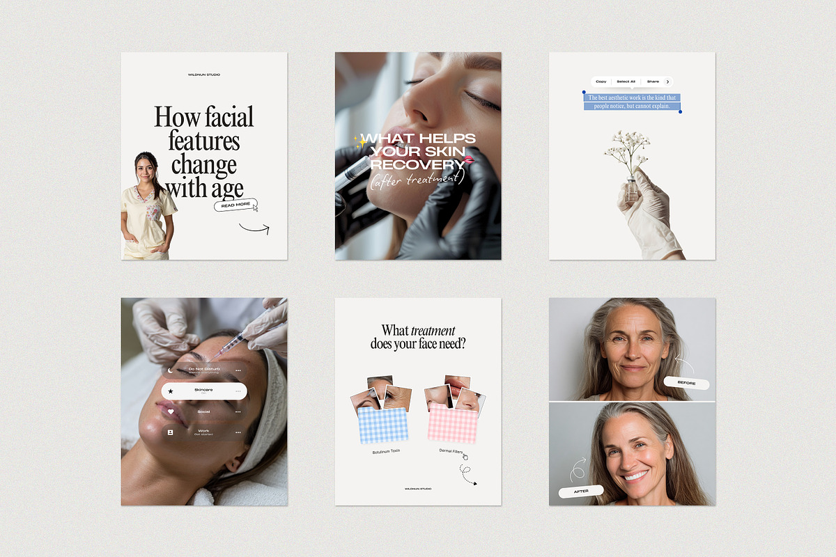 2026 Botox and Filler Instagram, a Social Media Template by Wildnun Studio (Photo 8 of 13)