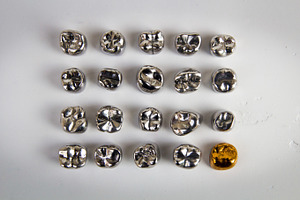 Dental  gold and metal tooth crowns isolated containing dental, crown, and
