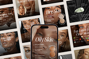 Skin Coach Instagram Templates, a Social Media Template by Xenié Creative (Thumbnail 1 of 8)