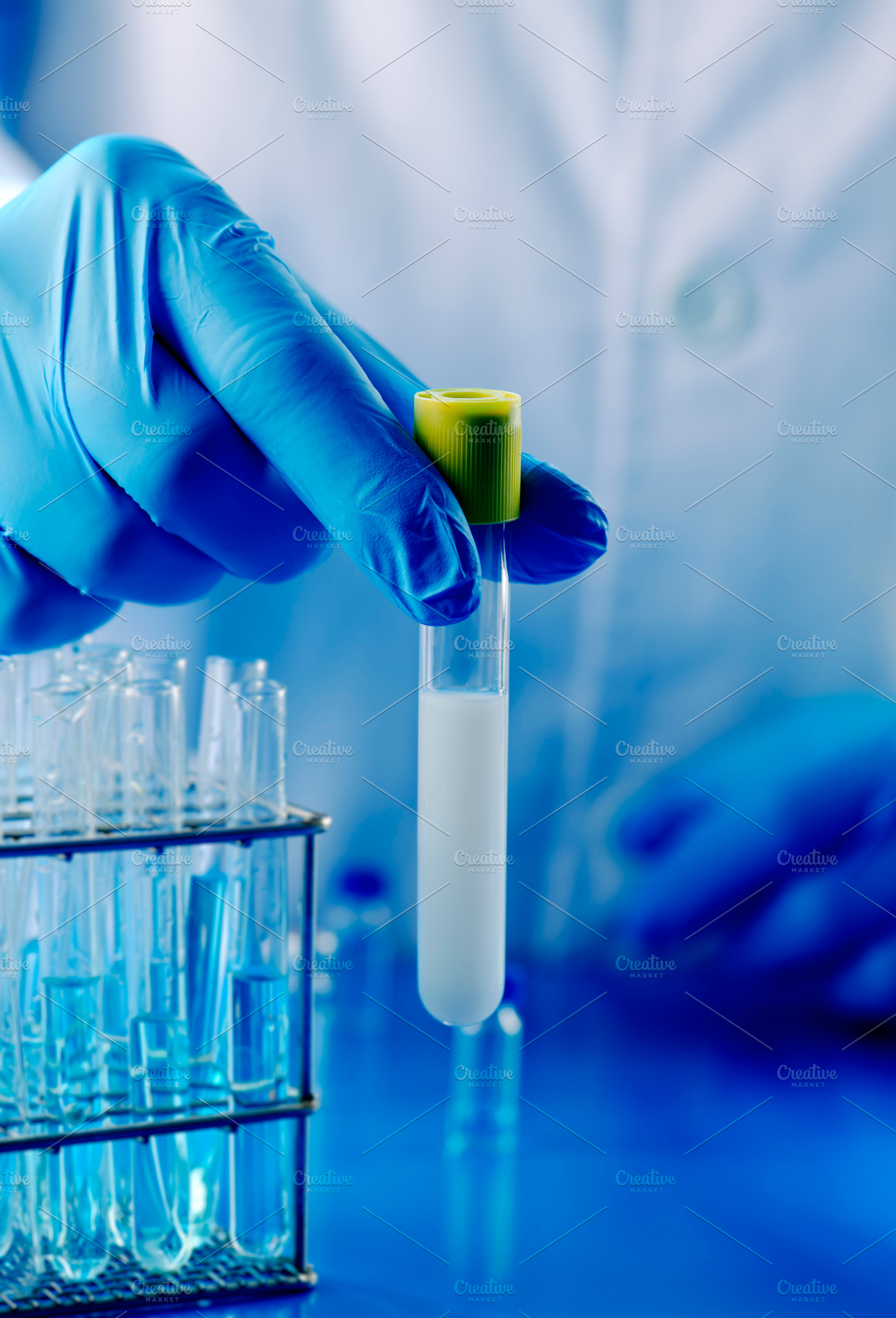 laboratory worker holding a test tube with semen, a Photo by Nito