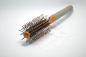 Hair loss