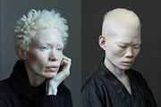 66 Albino persons, a Person Photo by Handmadefont (Thumbnail 7 of 10)