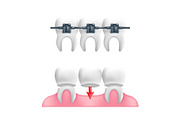 Dental Care Vector Icons set, an Emoji Icon by Rodionoff (Thumbnail 4 of 6)