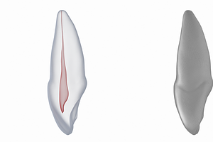 Upper Central Incisor With Pulp