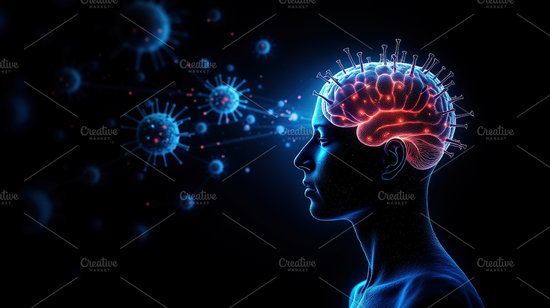 Brain Infection Concept with Virus a, a Health & Medical Photo by Perpis