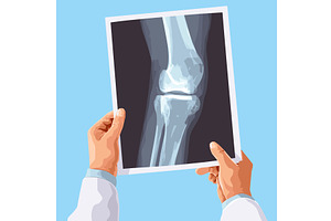 Hands hold x ray. Doctor Hand, an Object Illustration by Stock-Smart-Start