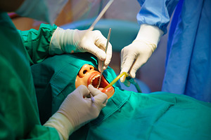 Dentist at work or Concentrated specialist removing tooth stone, a Health & Medical Photo by Casanowe-studio