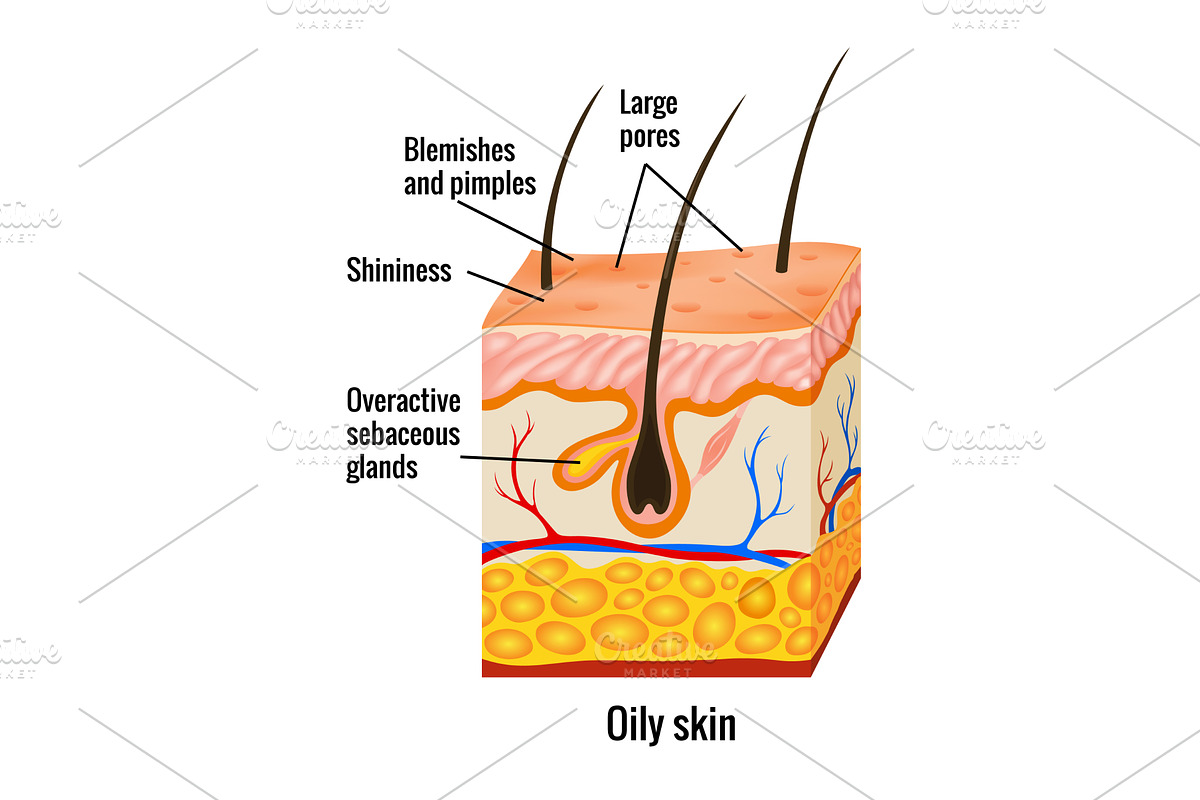 Oily skin anatomy. Human body, a Healthcare Illustration by Things for designers
