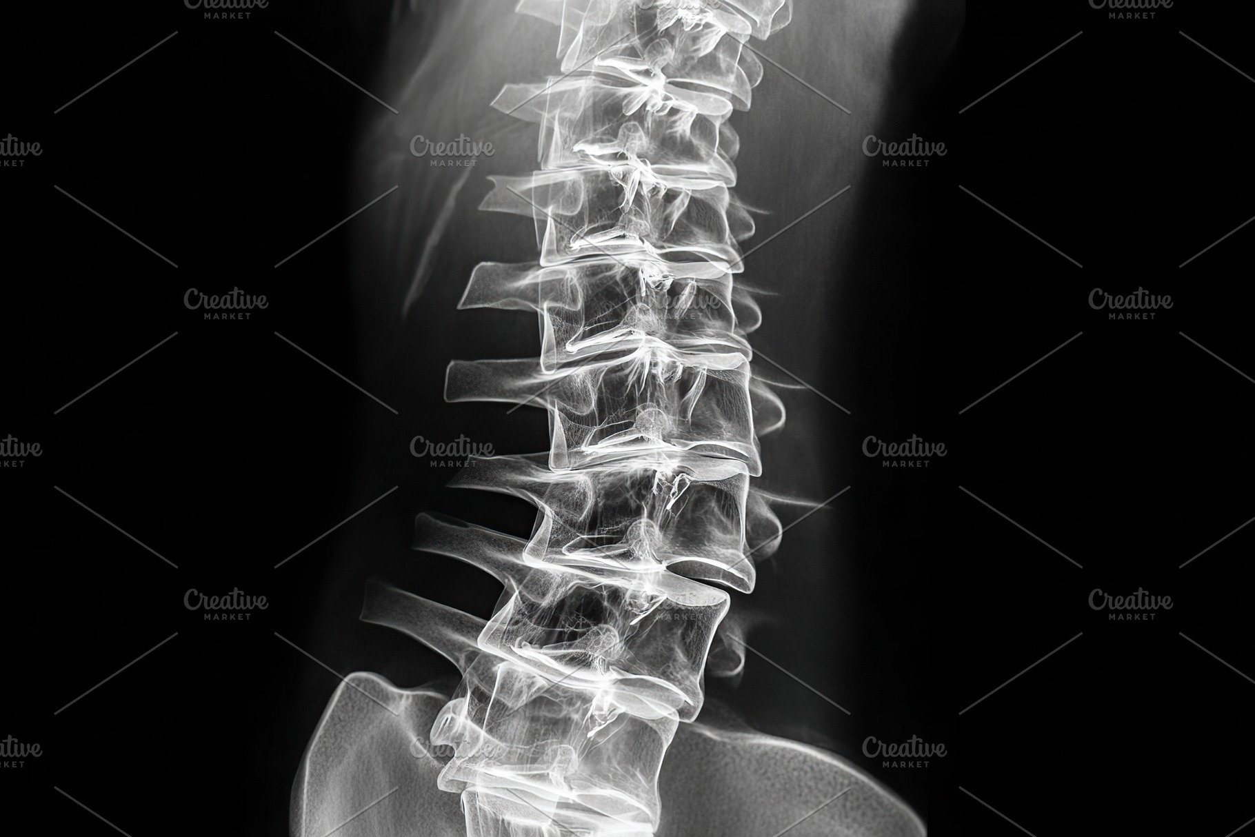 X-ray examination revealing lower spine abnormalities and potential concerns, a Health & Medical Photo by AlyaAnd