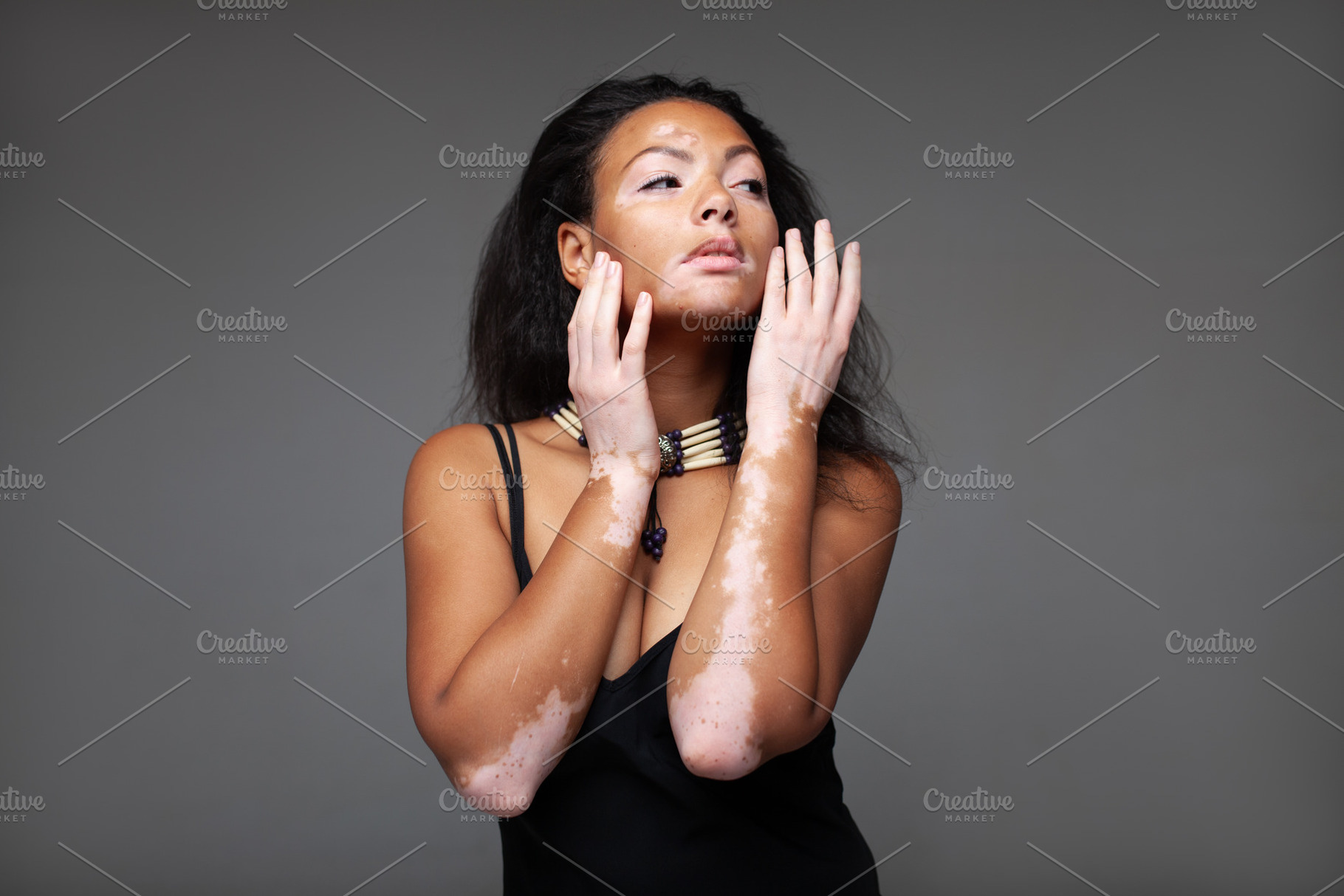 Sensuous fashion model with vitiligo posing over gray background, a Photo by andreonegin market