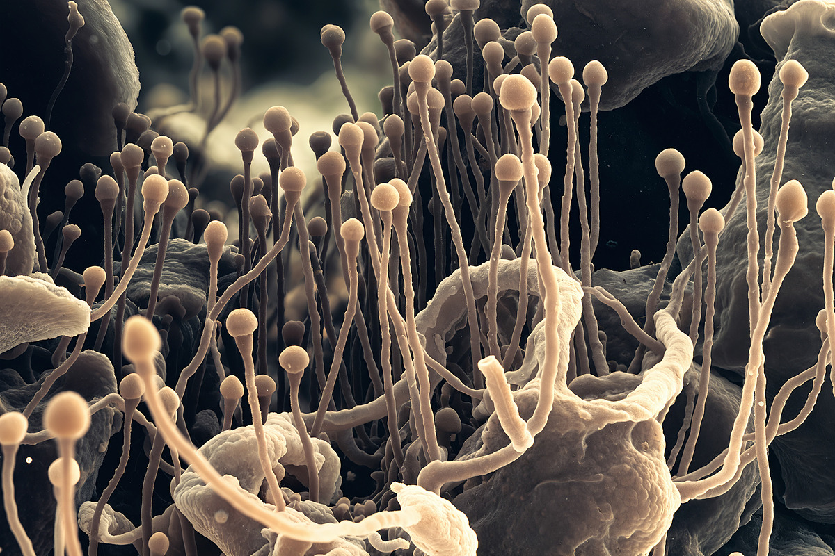 72 Microscopic Fungi Backgrounds, a Background Graphic by h.utomo (Photo 62 of 72)