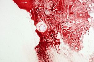 Blood spot, a Photo by saiko3p
