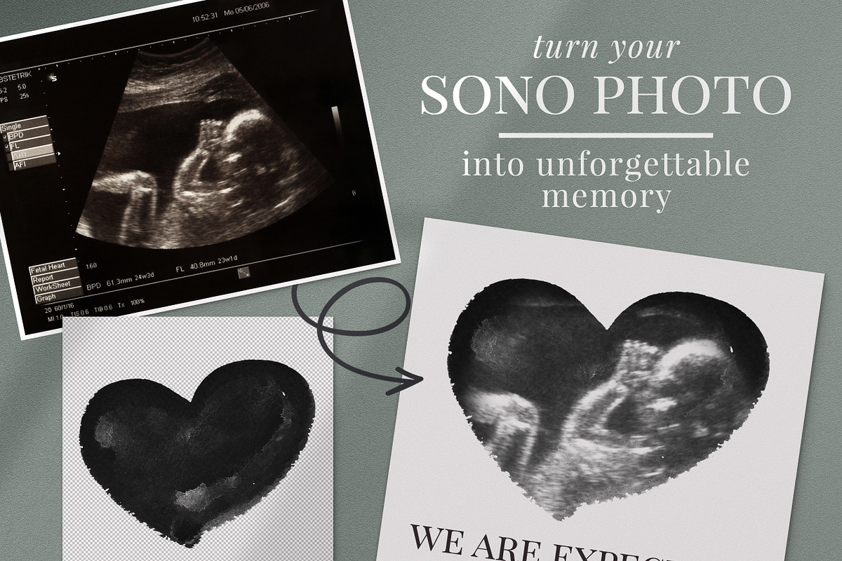 Watercolor ultrasound photomasks, a Layer Style Add-On by BrownLeopard (Photo 3 of 11)