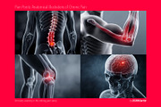 Pain Points, a Health & Medical Photo by OSORIOartist (Thumbnail 4 of 4)