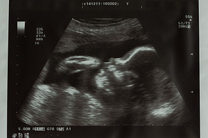 Ultrasound picture of baby containing ultrasound, baby, and pregnancy, a Health & Medical Photo by NelliKovalchuk