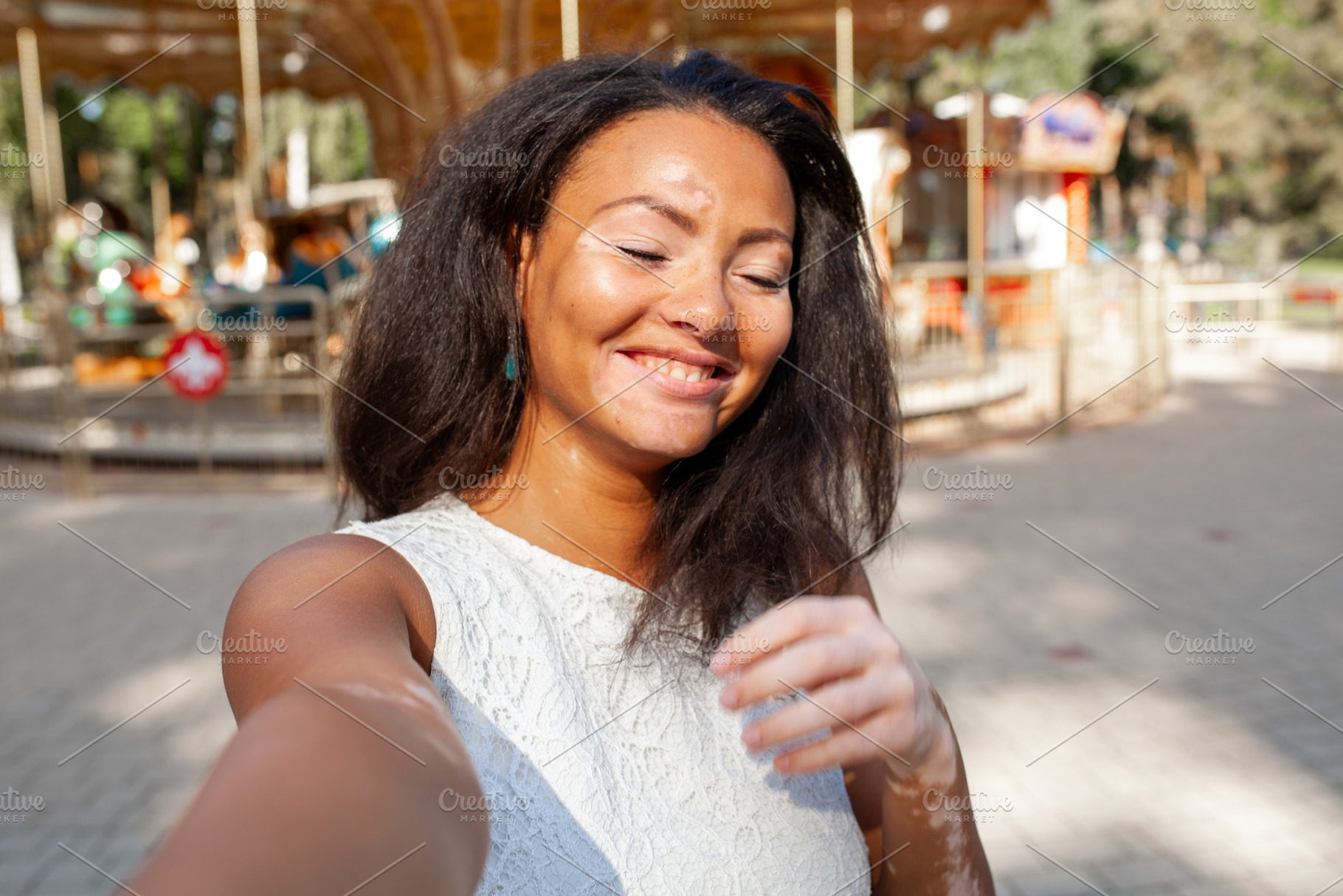 Happy woman with vitiligo skin problem taking selfie in city park, a Person Photo by andreonegin market