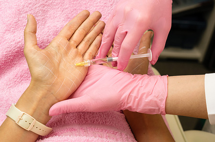 Treatment hyperhidrosis botulinum, a Health & Medical Photo by Elena Vagengeim