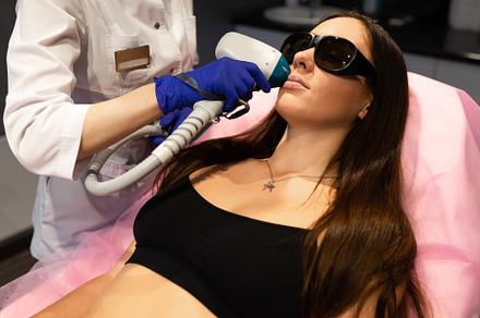 Face laser hair removal procedure, a Photo by borodai94