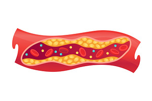 Type of cholesterol in human, an Object Illustration by Things for designers
