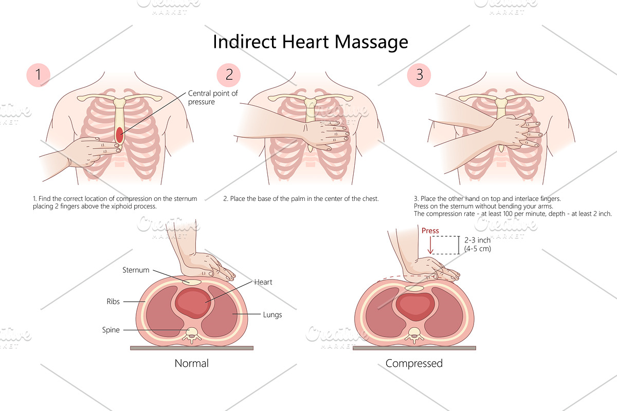 Step-by-Step Guide to Indirect Heart, a Healthcare Illustration by AlexArt