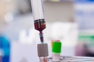Close up blood sample for diagnosis and treatment patient in the, a Photo by Casanowe-studio