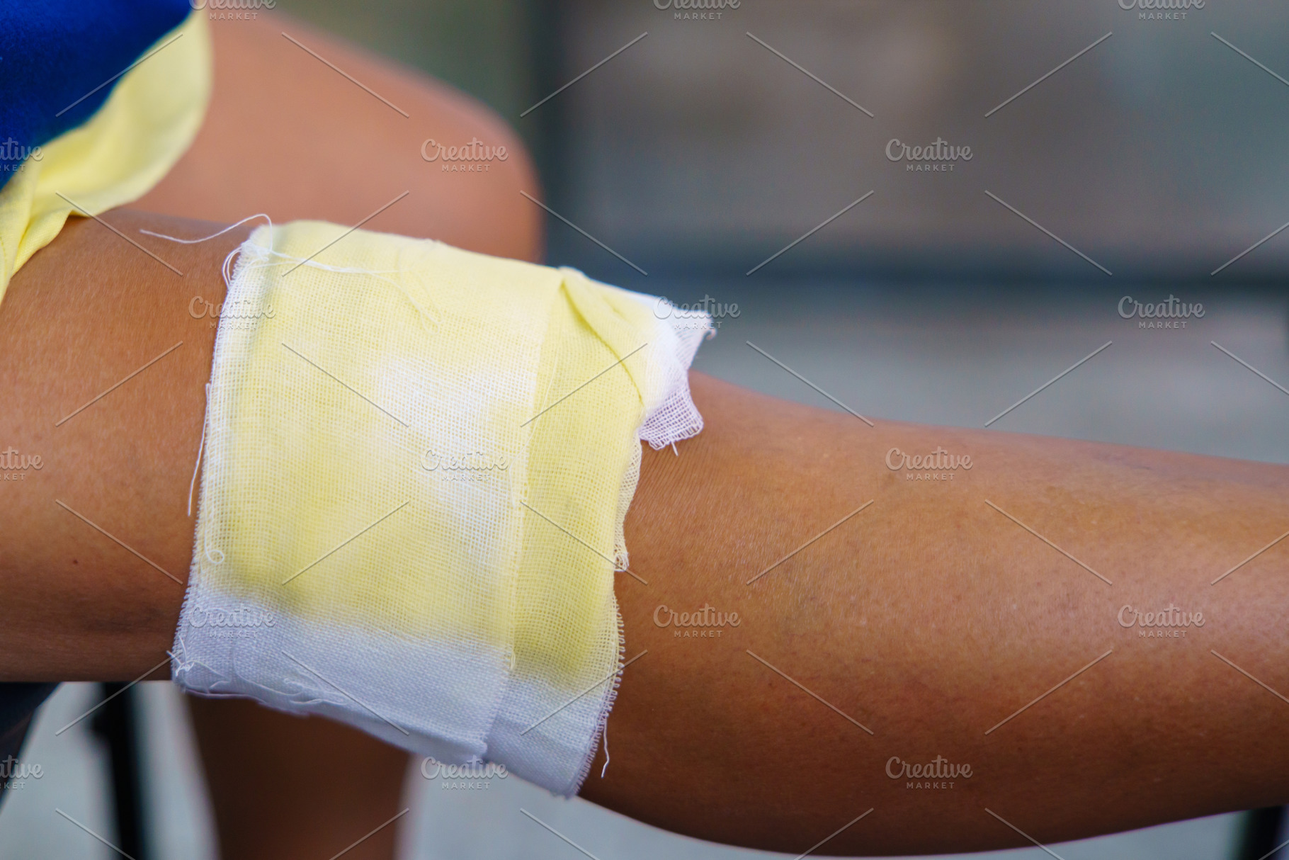 Knee pain in an elderly person use thai herbal compress ball or, a Health & Medical Photo by Casanowe-studio