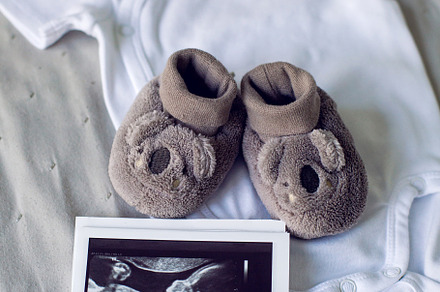 photo ultrasound with a child lying, a Person Photo by SaulichPhoto