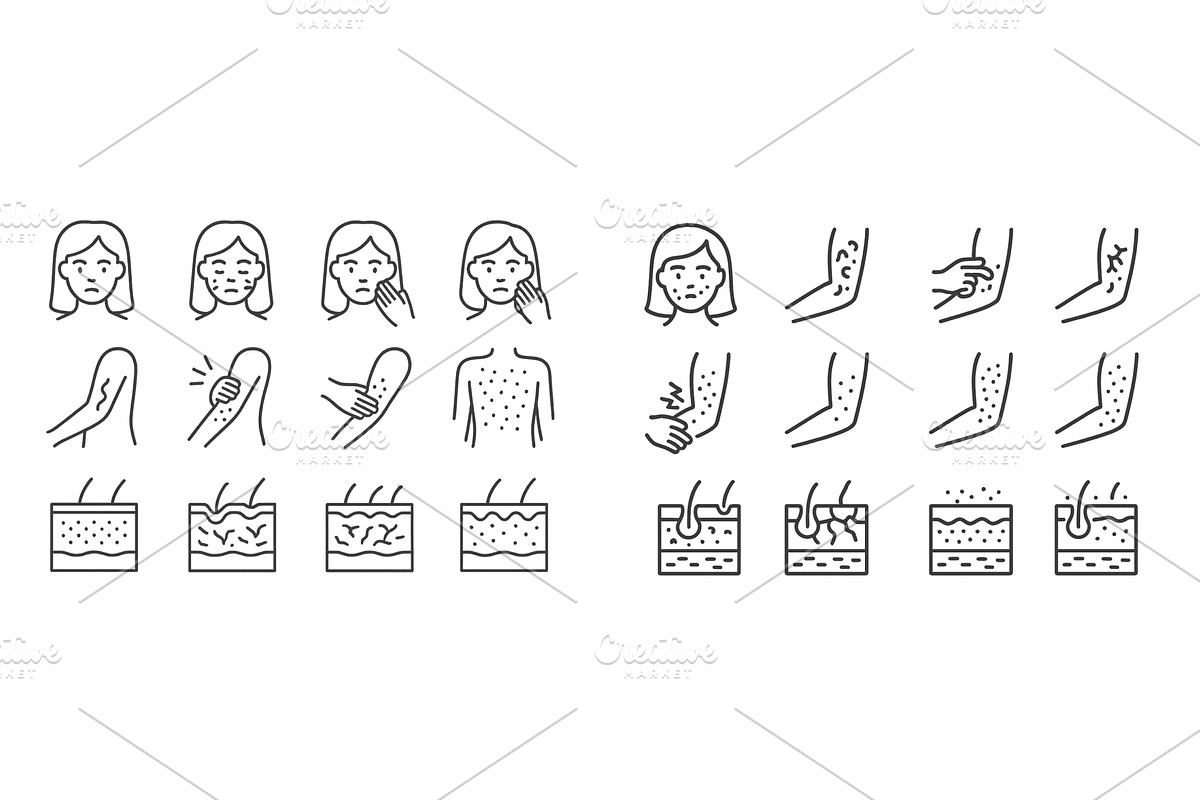Skin conditions and their symptoms, an Object Illustration by ZinetroN