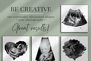 Watercolor ultrasound photomasks, a Layer Style Add-On by BrownLeopard (Thumbnail 5 of 11)