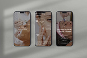 Microneedling Instagram Template, a Social Media Template by Terraa Studio Design (Thumbnail 5 of 6)