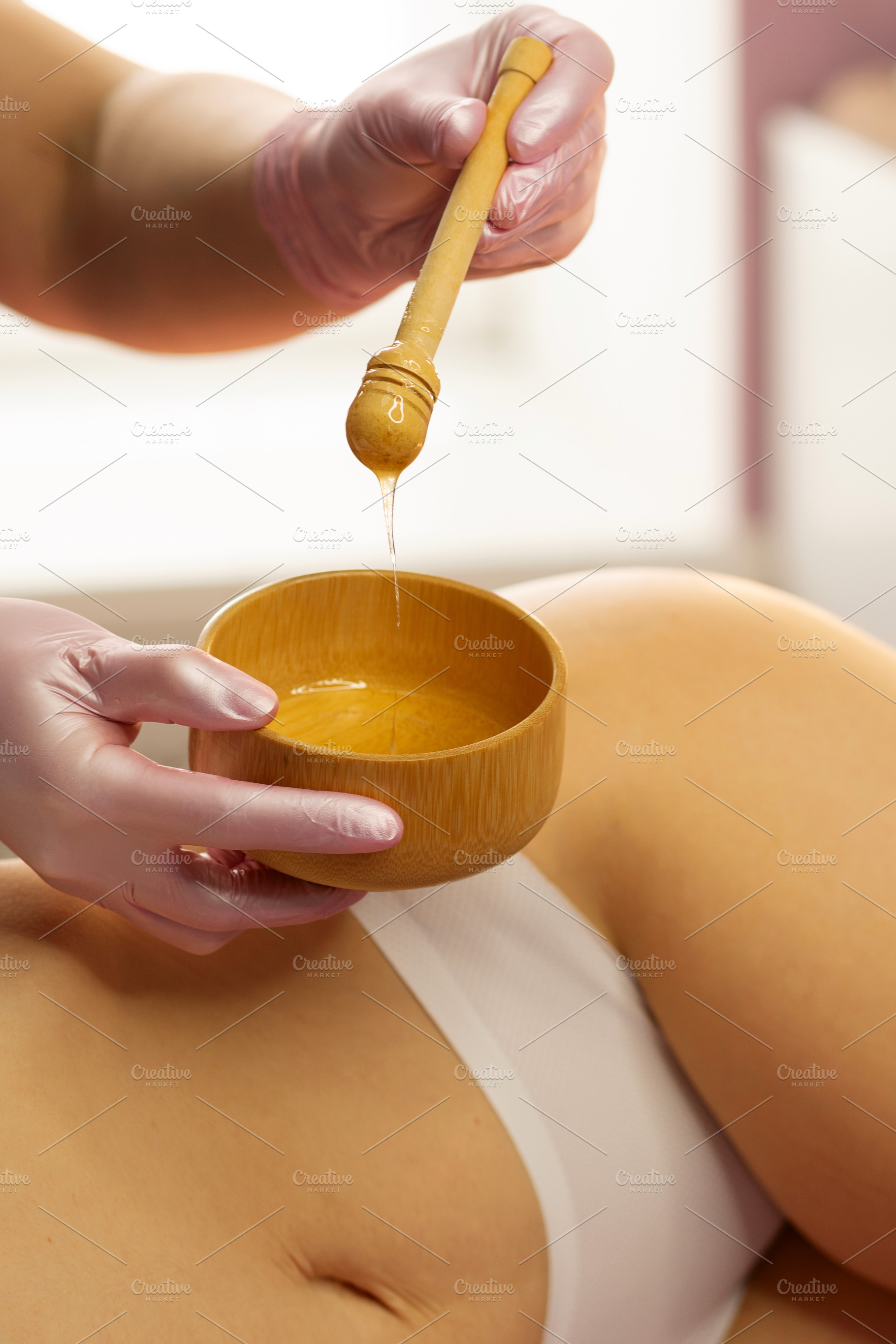 Gloved therapist lifts honey mixture, a Health & Medical Photo by Elena Vagengeim