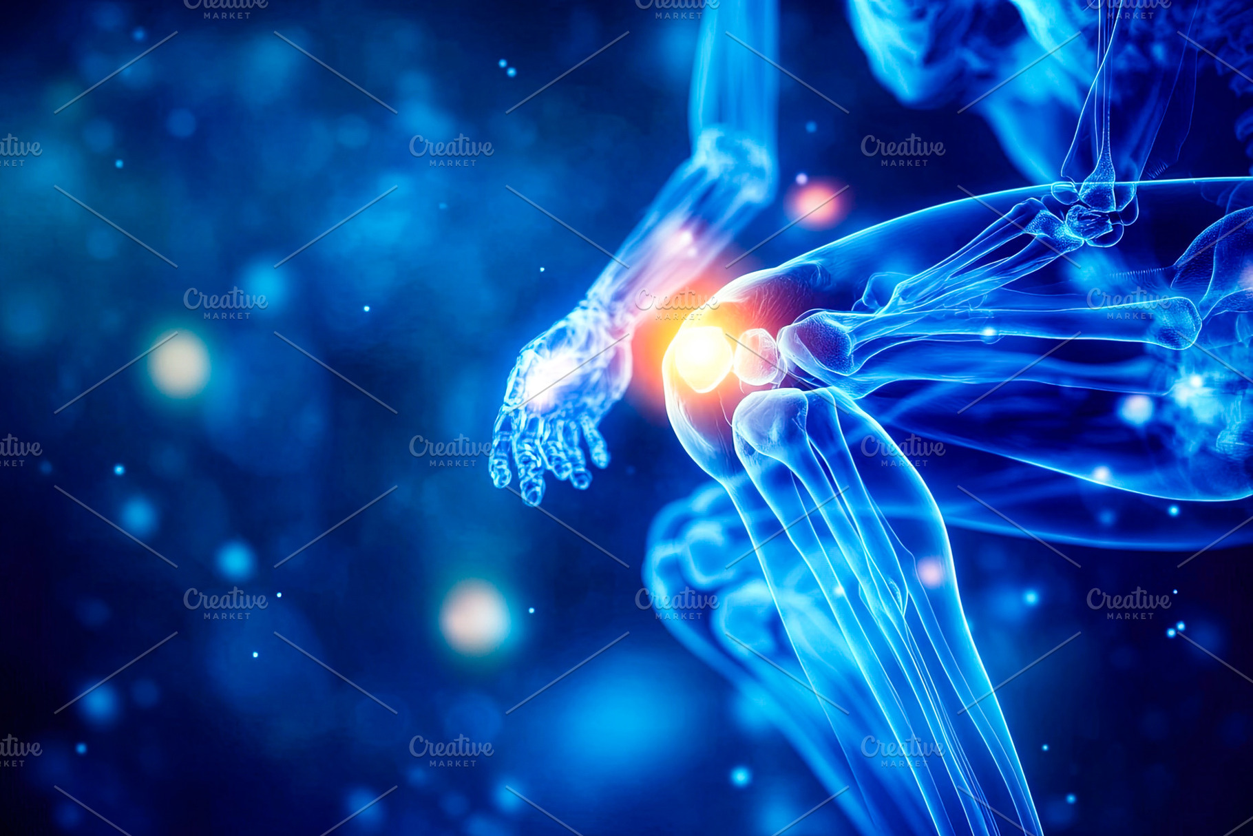 Knee Joint Pain Concept, a Health & Medical Photo by Ales Munt