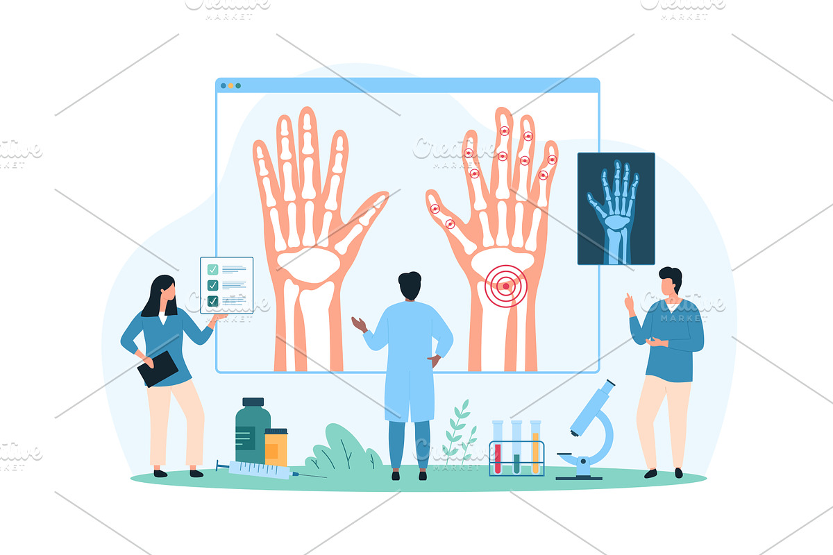 Arthritis diagnosis treatment plan, an Object Illustration by Flashvector