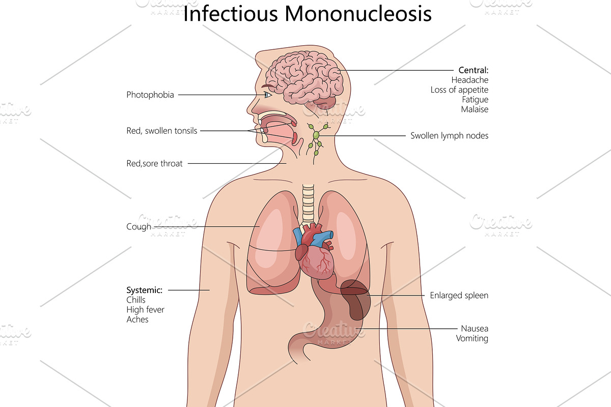 Symptoms and Effects of Infectious, a Healthcare Illustration by AlexArt