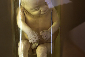 Human fetus 6 th month in glass container with formalin, a School & Education Photo by Bepslabor