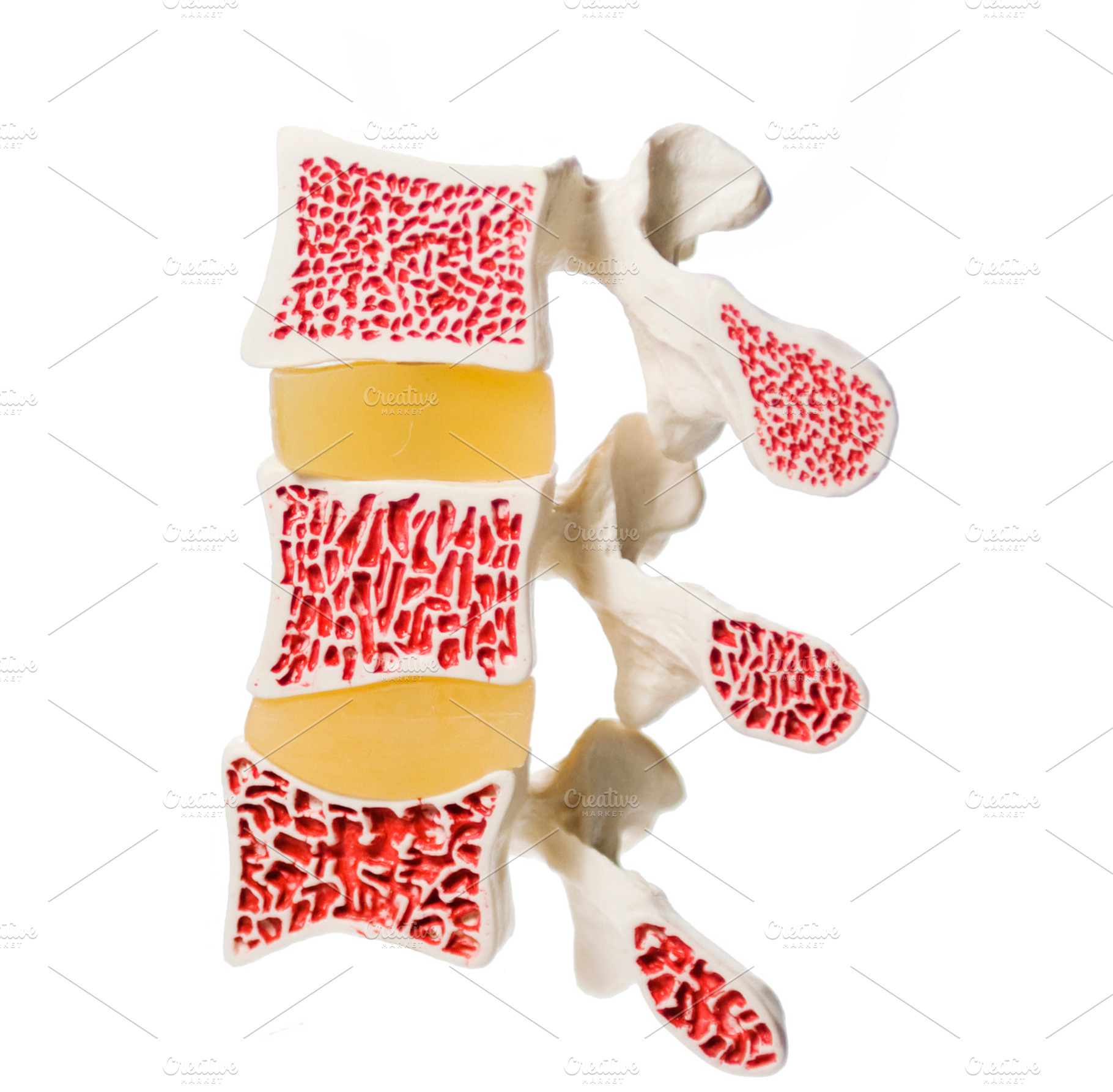 Artificial model of osteoporosis
