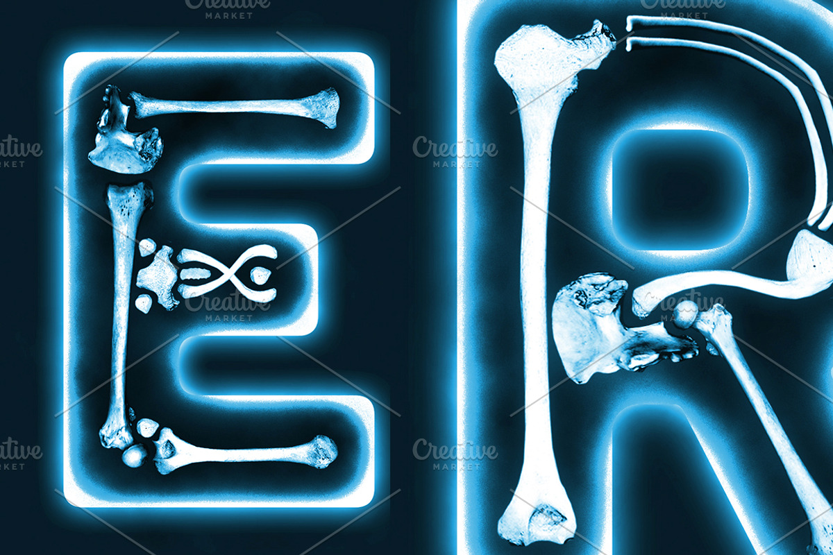 The X-Ray Type preview 2