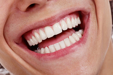 Smile containing care, clean, and closeup preview 6