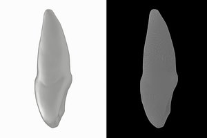 Human Upper Left Central Incisor