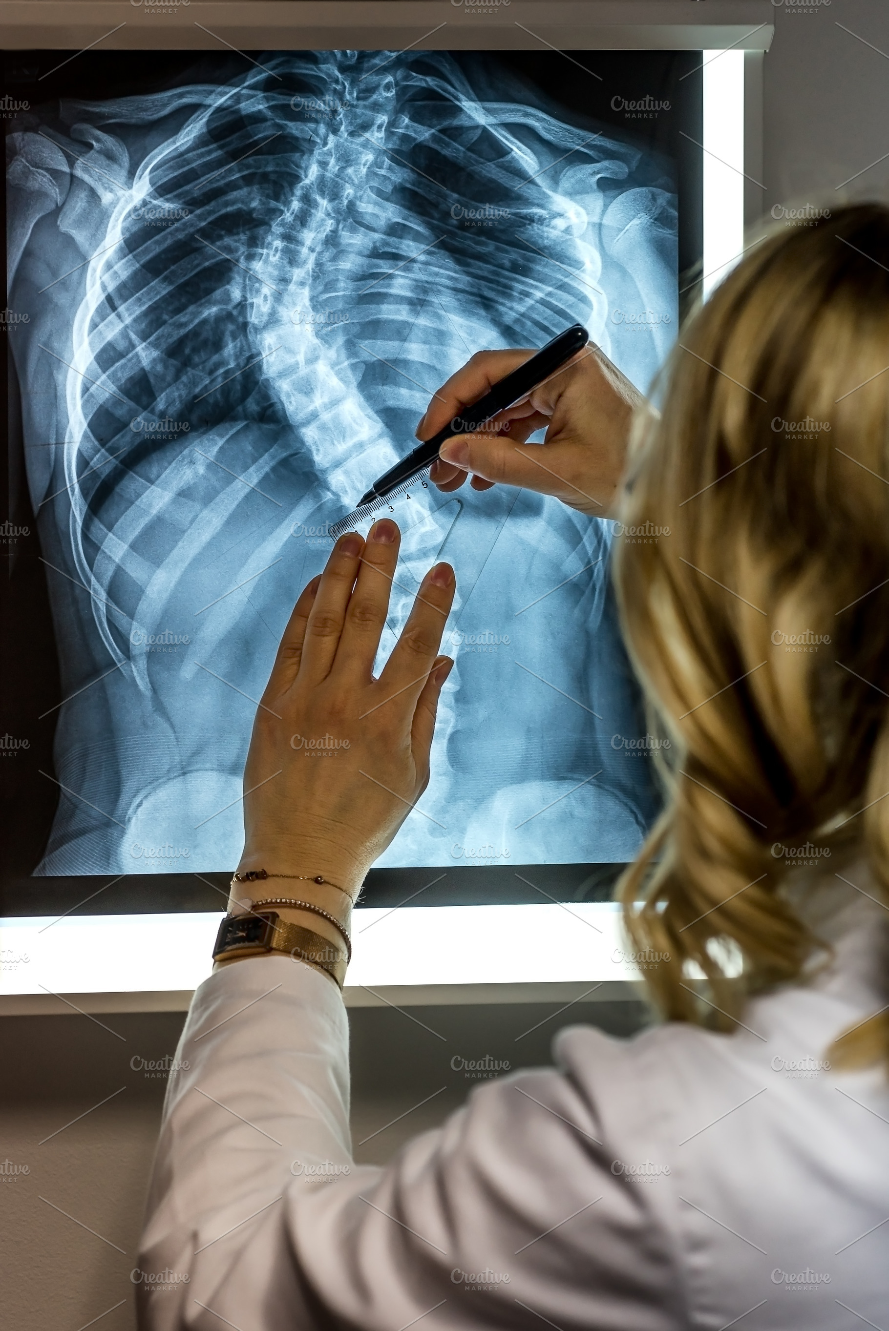 Doctor with patients X-Ray, a Photo by wr7 Media