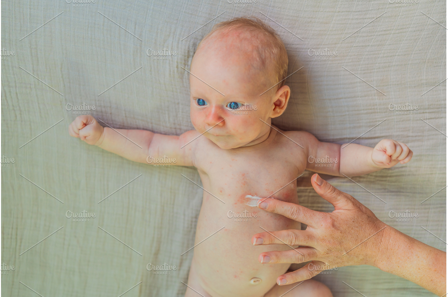 Mother applying anti-rash cream on, a Health & Medical Photo by Elizaveta Galitskaya
