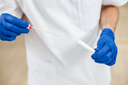 Closeup dna test tube and cotton swab wipe test in man hands containing